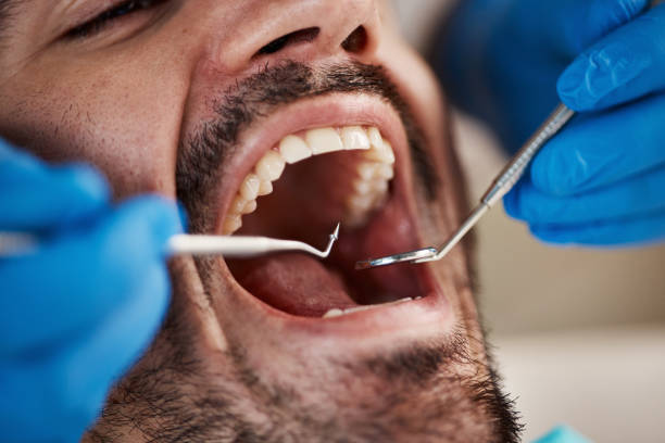 Best Affordable Emergency Dental Care  in Trail Creek, IN